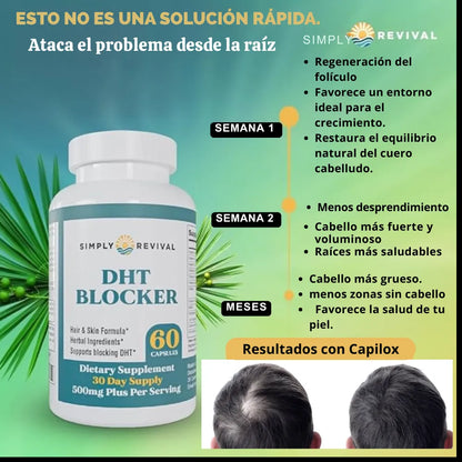 Capilox™ – Bloqueador Natural de DHT para un Cabello Más Fuerte y Abundante